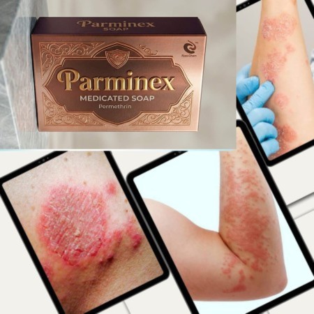 Parminex Soap